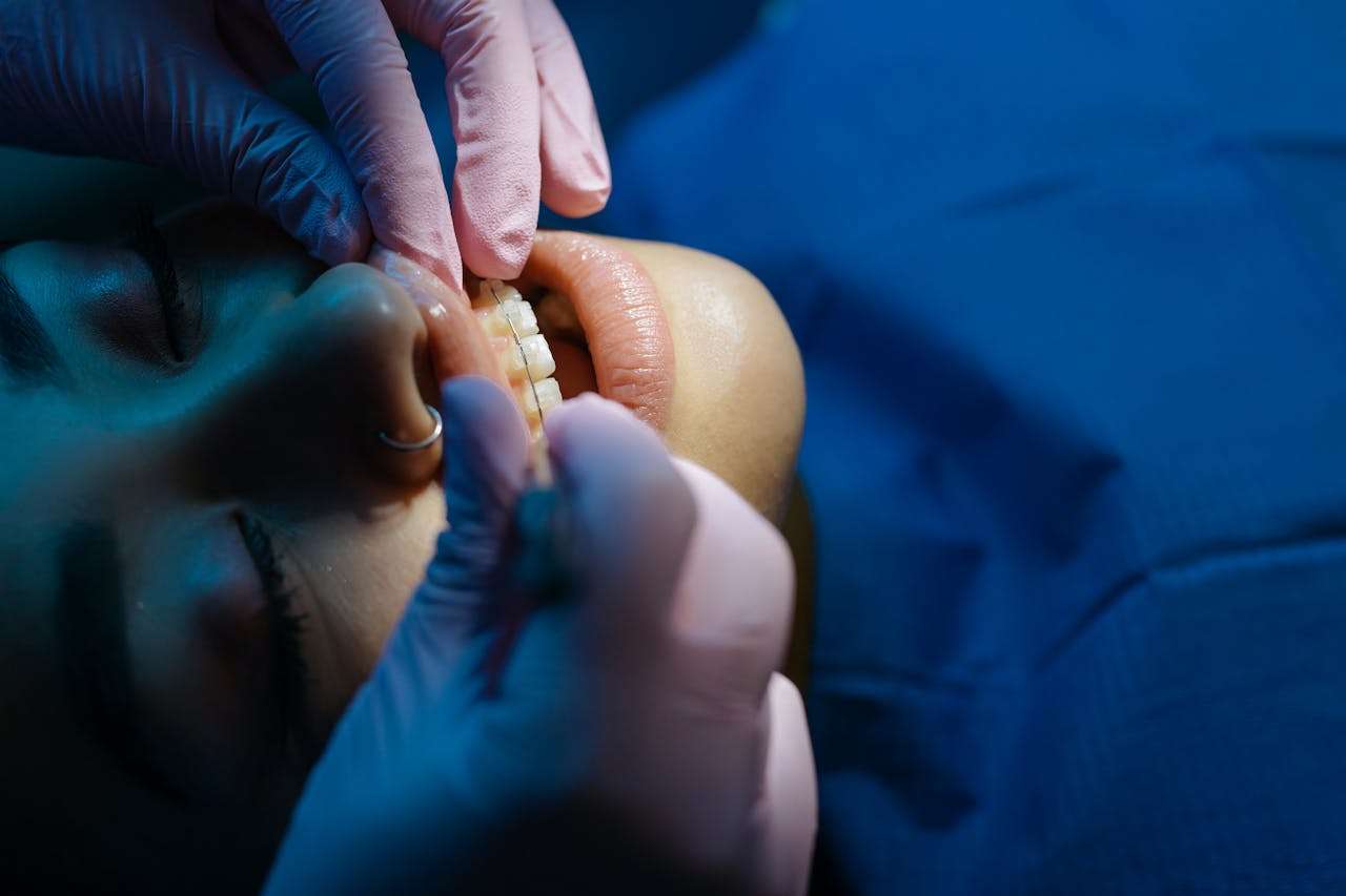 Dental Negligence
